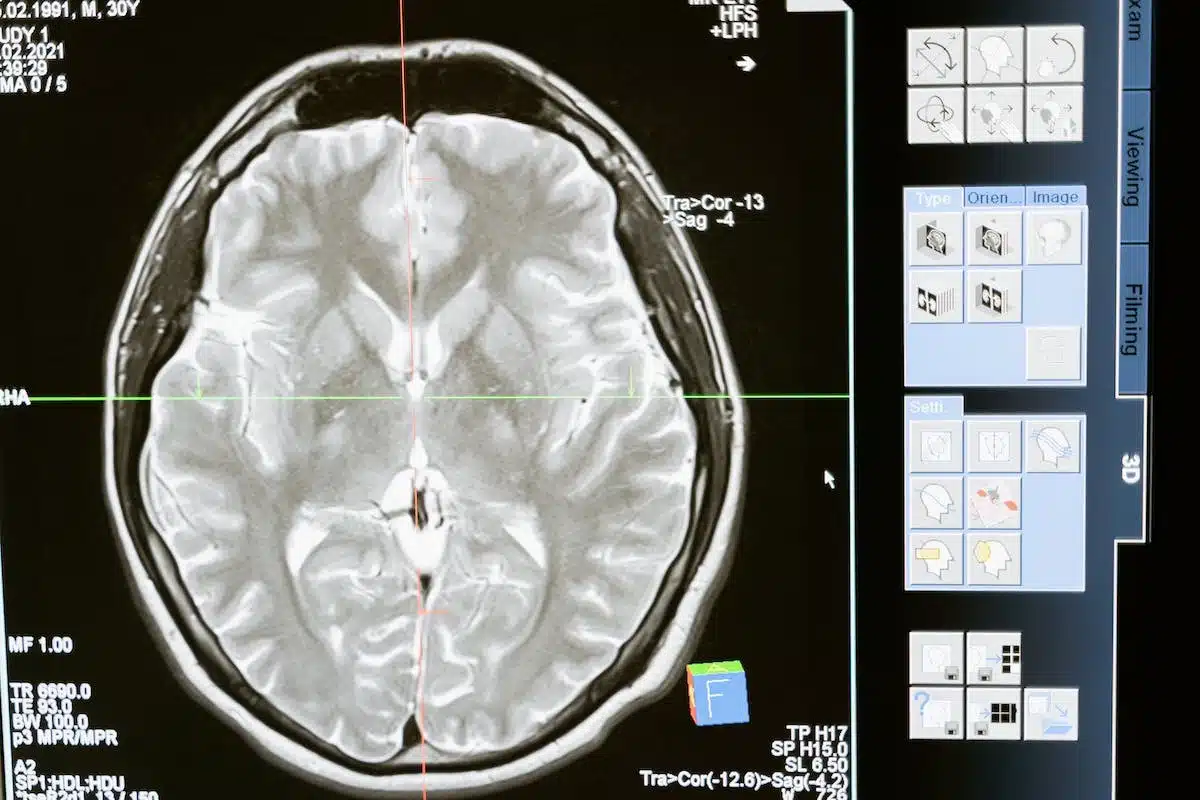 cerveau  cognition